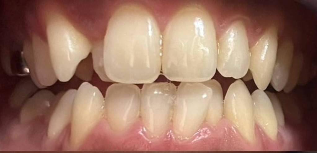 医療シートbefore