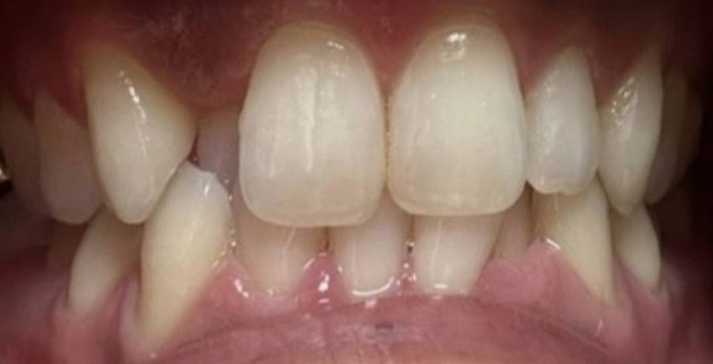 医療シートafter