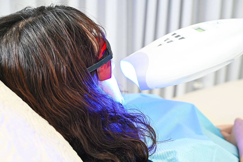 美容セルフホワイトニング